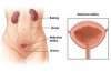 Infekcije urinarnog sistema kod žena infekcije-urinarnog-sistema-kod-žena