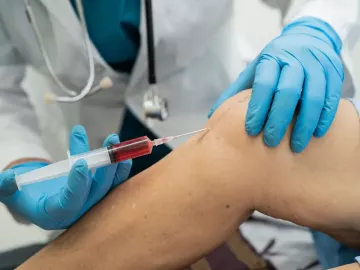 PRP tretman u ortopediji, kardiohirurgiji, ginekologiji, dermatologiji i estetskoj hirurgiji